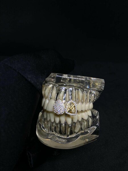 Dents préciieuses en strass