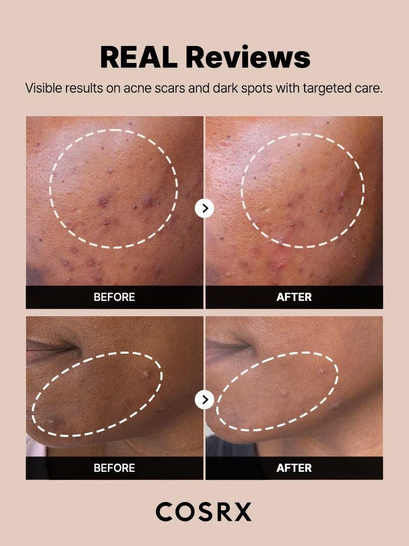COSRX Discoloration Serum