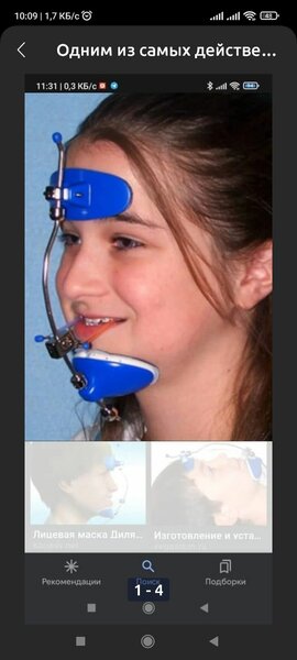 Ортодонтия маска Деляра