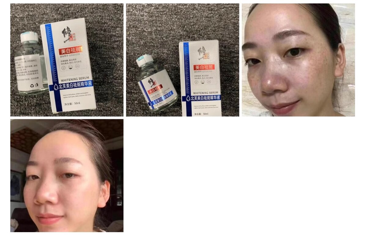 сыворотка беттеги так сепкил кетируу учун