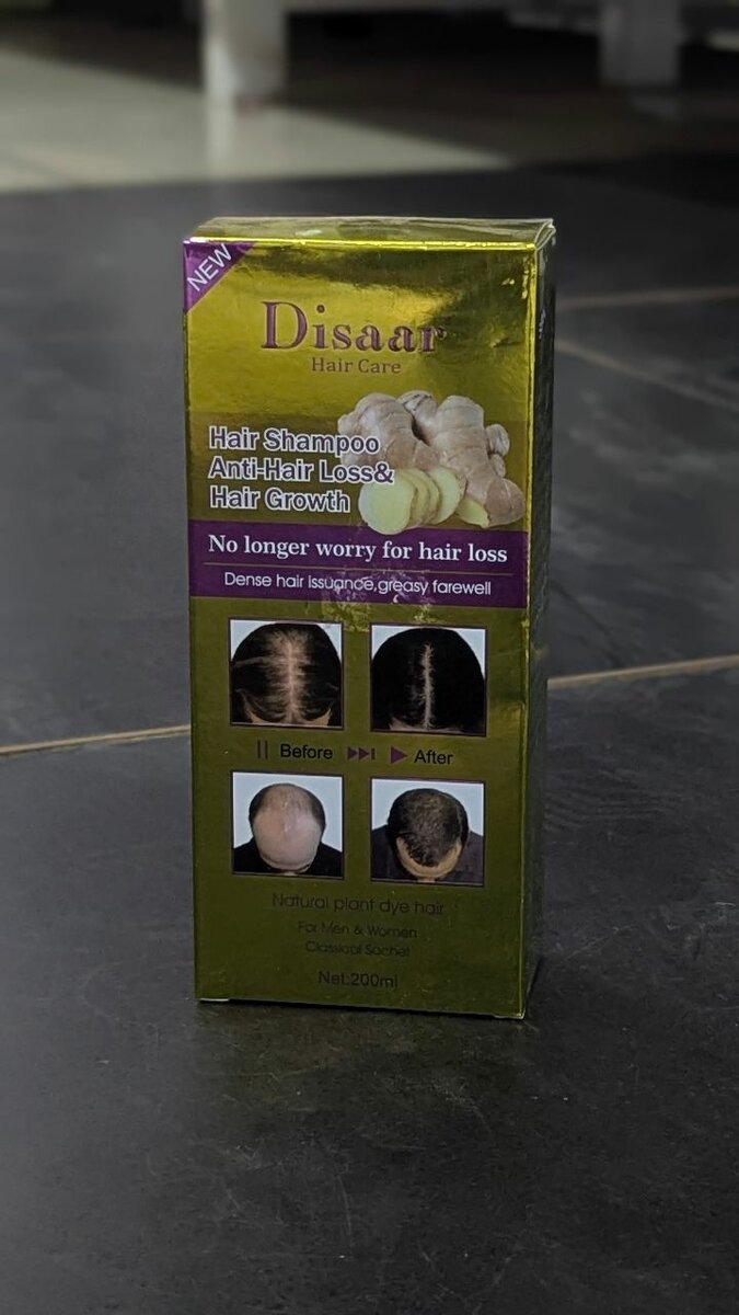 HAIR LOSS TREATMENT