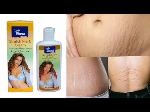 LADY DIANA STRETCH MARKS CREAM