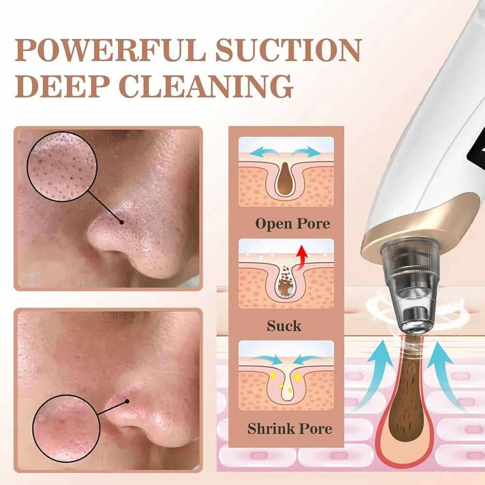 Appareil d'aspiration visage