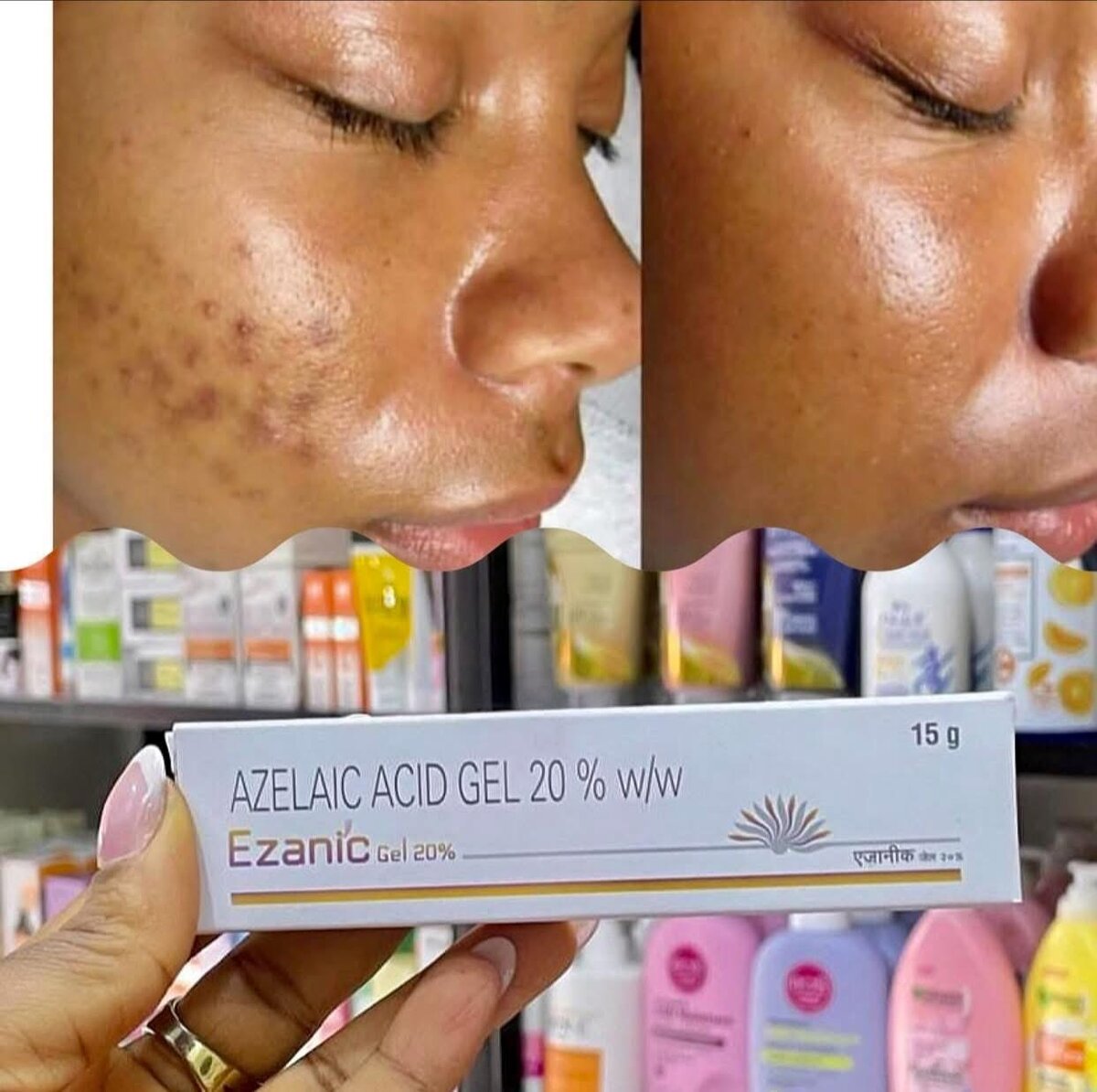 Sérum anti-taches et éclat