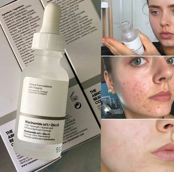 Serum niacinamide the ordinary