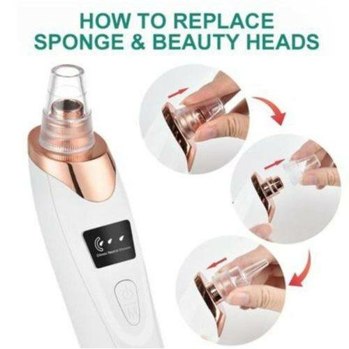 Aspirateur de Points Noirs