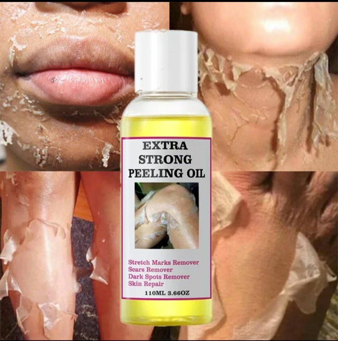 Huile peeling extra