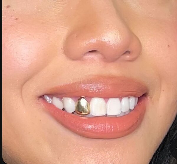 Grillz teeth