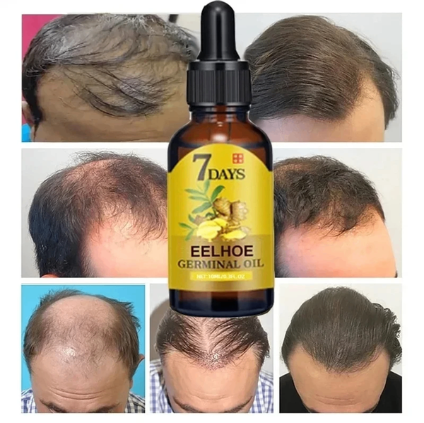 Huile Germinative Cheveux Eelhoe