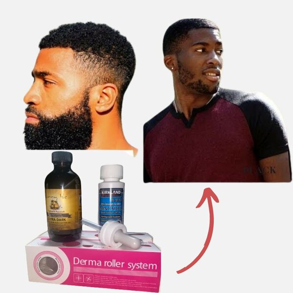 Kirkland Minoxidil & Roller & Castor Oil For Beard Growth