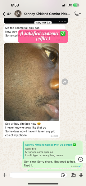 For Beard growth & Baldness