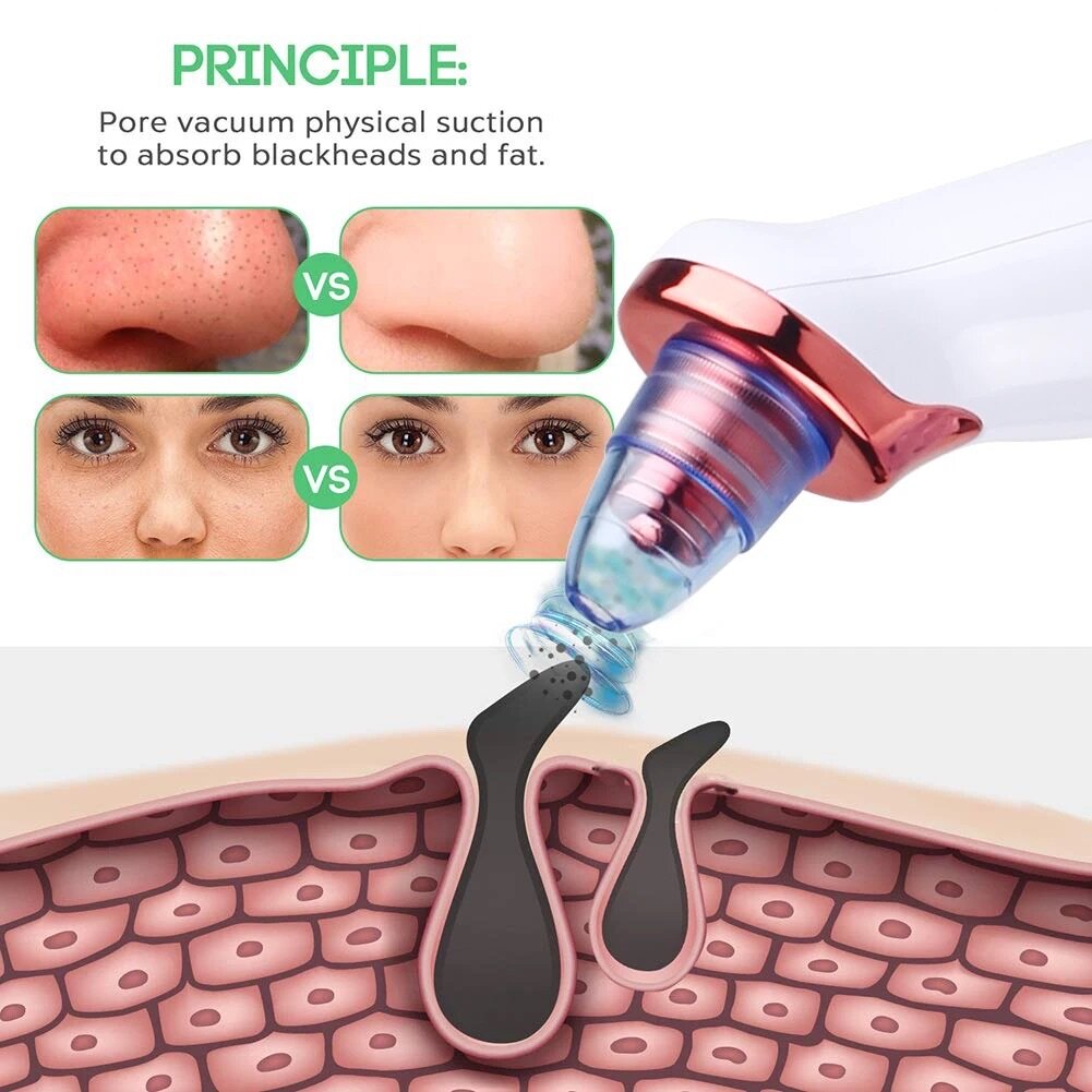 Extracteur de graisse du visage