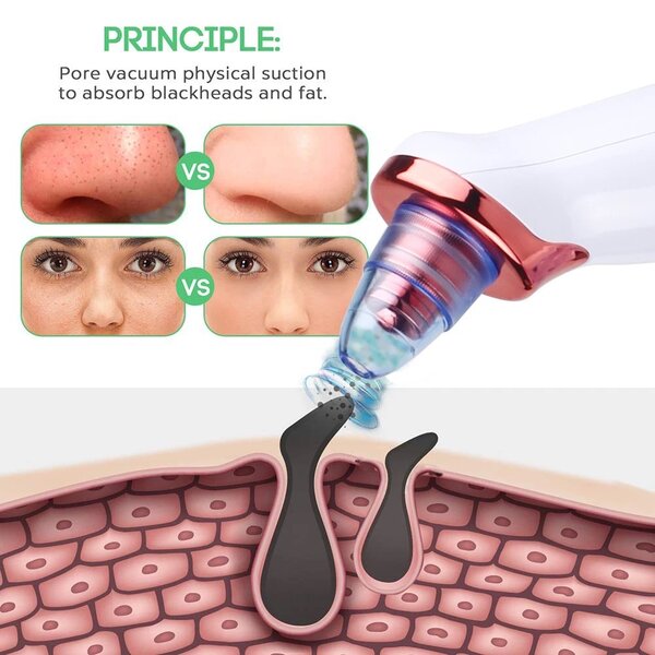 Extracteur de graisse du visage