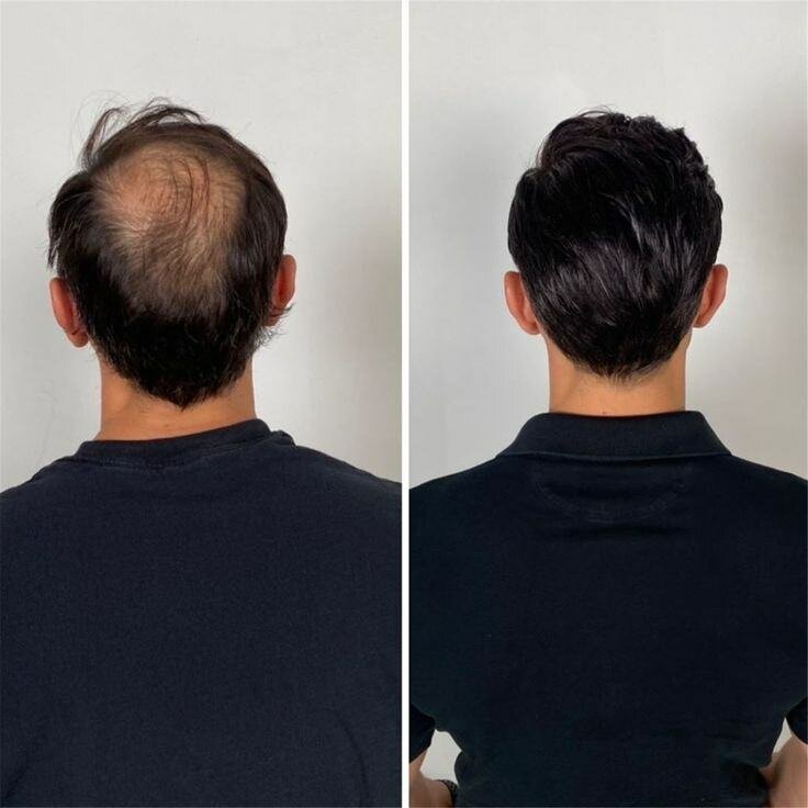 Huile de Croissance Barbe Naturelle