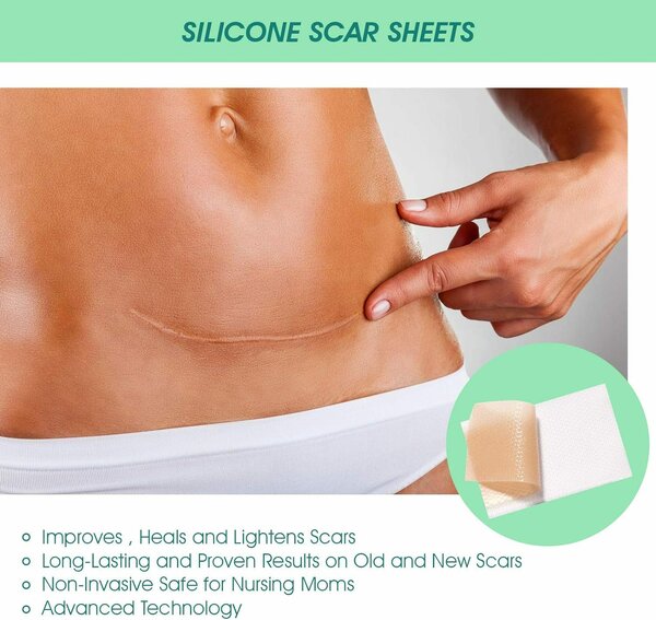 Silicone Scar sheet