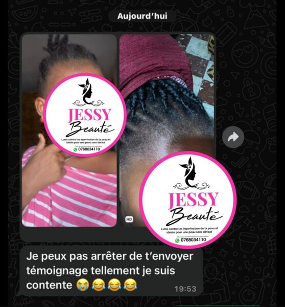 Pousse cheveux Rapide