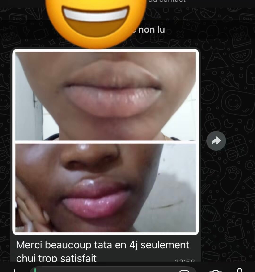 Kit Soin des Lèvres Complét