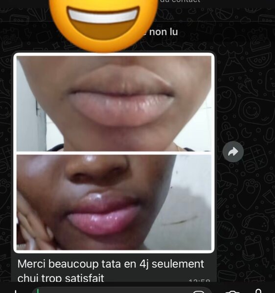 Kit Soin des Lèvres Complét