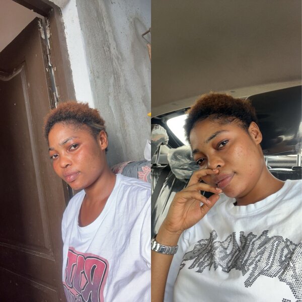 Crème action rapide