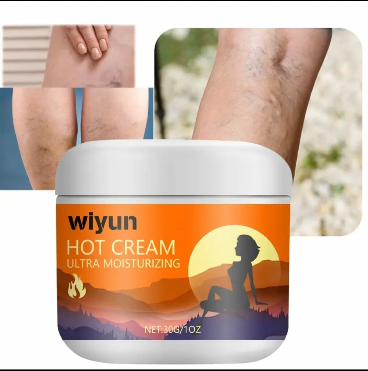 Vergetures & varice jambe 30 g