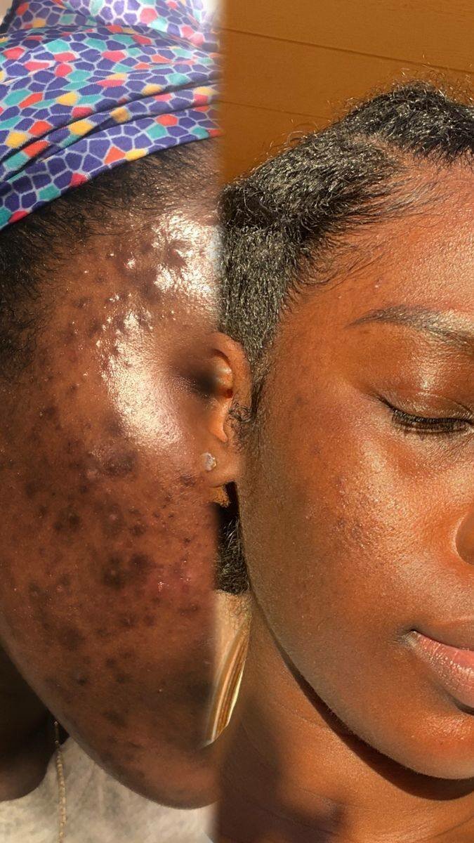 Poudre d'argile verte