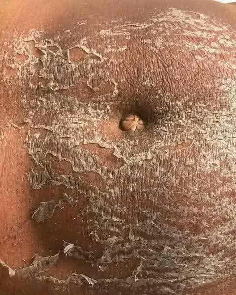 Crème Anti-Vergetures