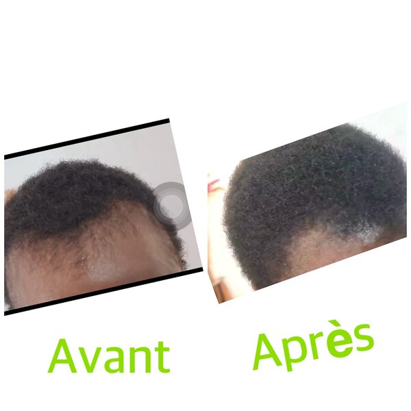 Huile Croissance Cheveux Rapide