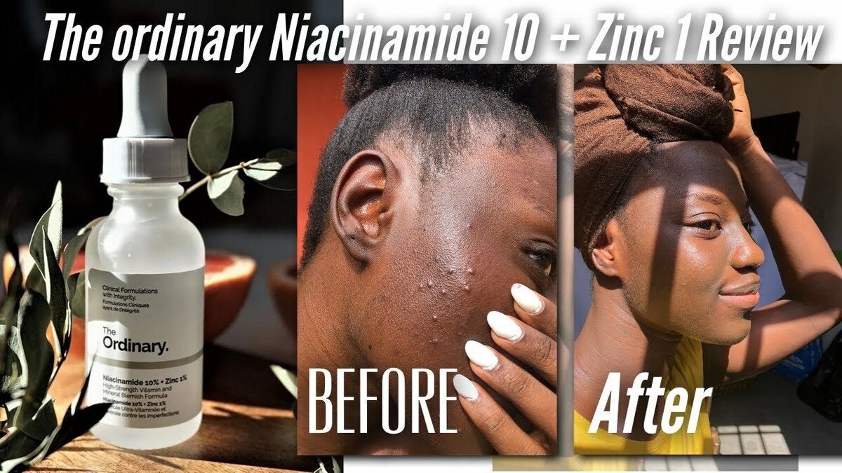 The Ordinary Niacinamide 10% + Zinc 1% 60ml