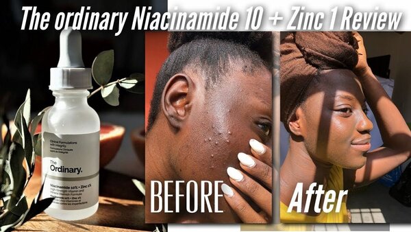 The Ordinary Niacinamide 10% + Zinc 1% 60ml