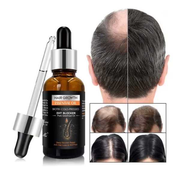 Huile Essentielle Croissance Cheveux