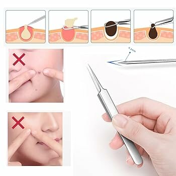 Extracteur de Comédons Acier Inox