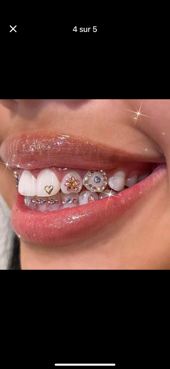 Clous d'Oreilles Magnétiques Éclatants