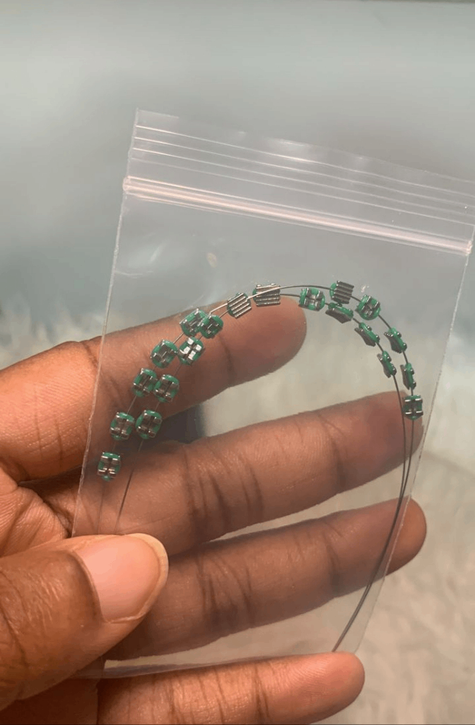 Fashion teeth braces