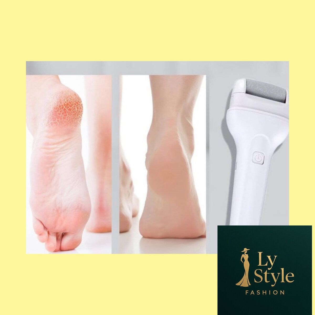 Râpe Électrique Pieds Anti-callosités