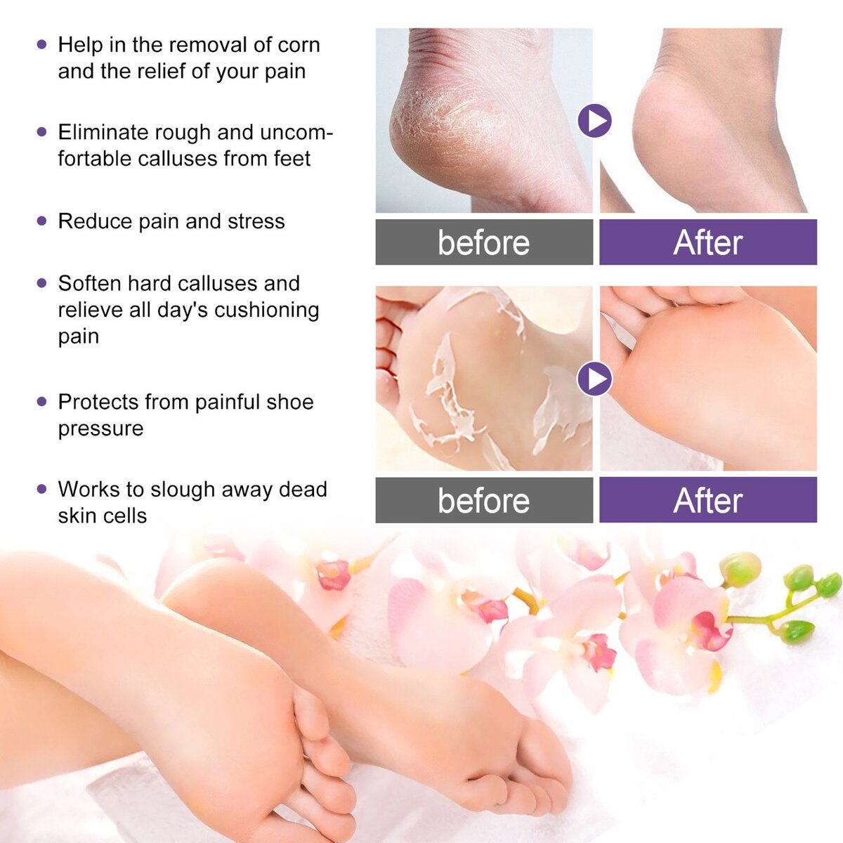 Foot peeling mask