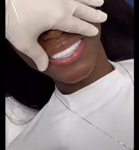 Kit de Blanchiment Dentaire LED