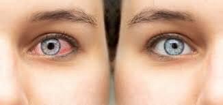 VISINE ORIGINAL fini les yeux rouge
