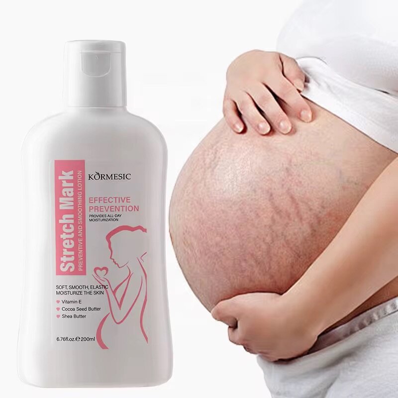 crème lotion pour vergetures