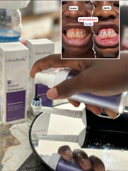 GlorySmile Correcteur Dentaire