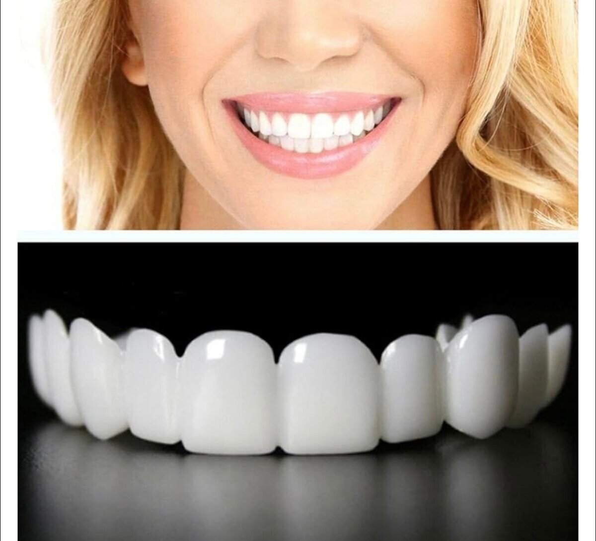 Facette dentaires amovibles