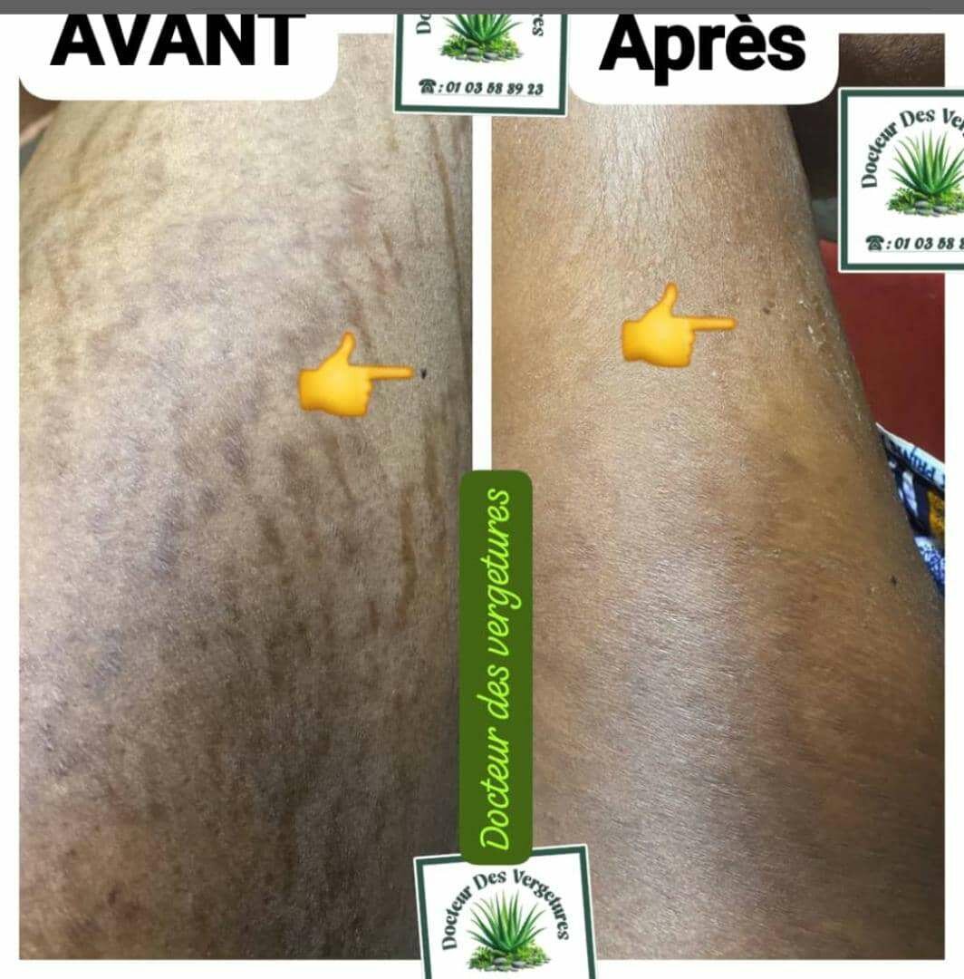 Kit de produits cosmétiques