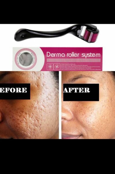 Derma roller for hair and skin