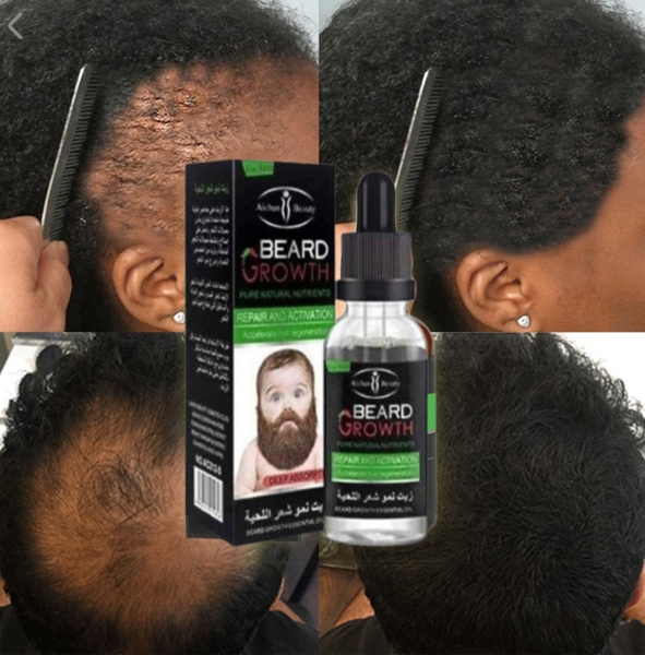 Huile à Barbe Croissance Naturelle