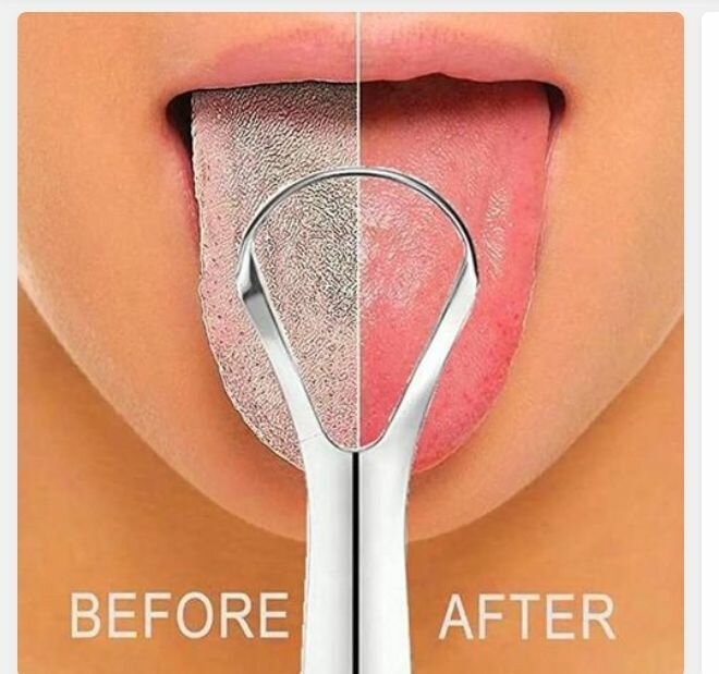 TONGUE SCRAPERS