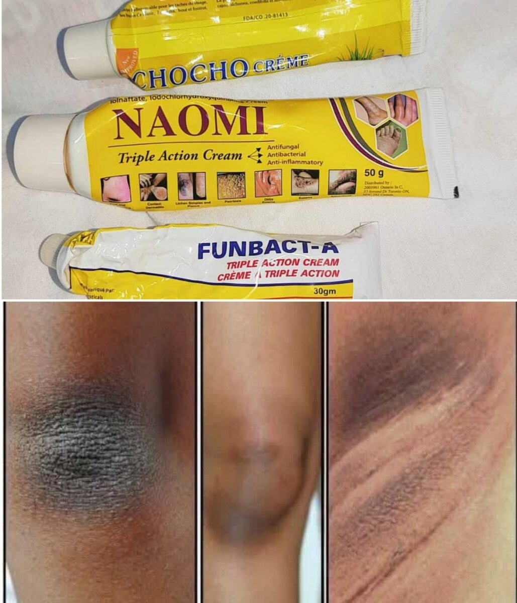 Triple action creams