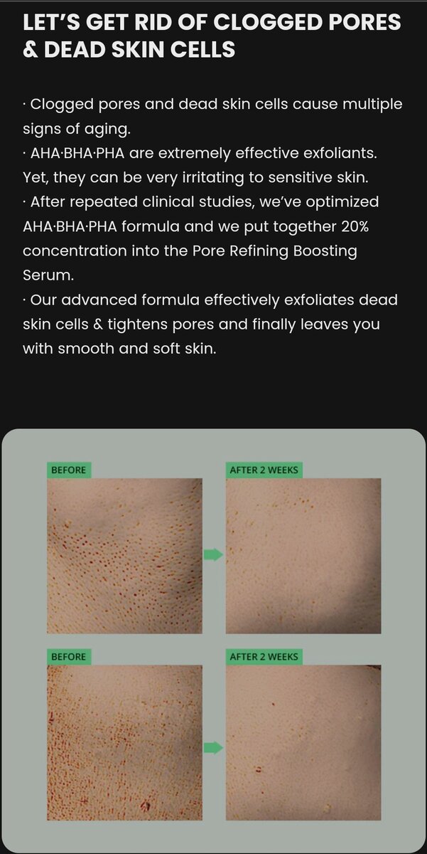 Serum AHA BHA PHA 20% Pores