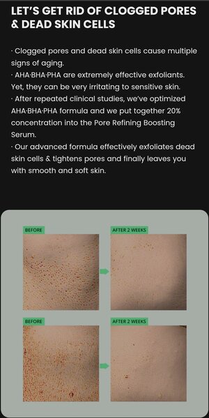 Serum AHA BHA PHA 20% Pores