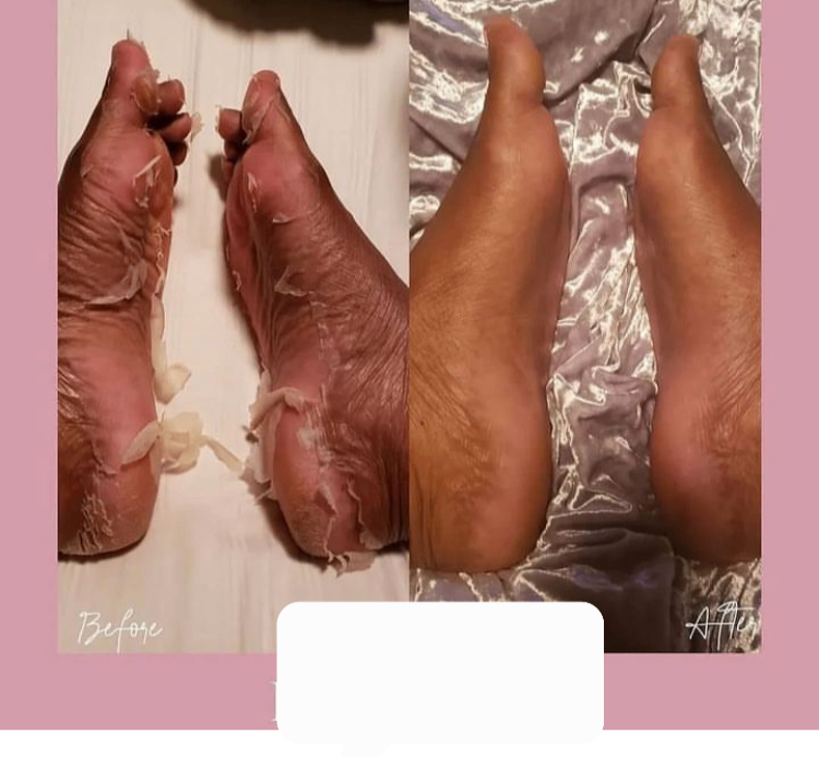 masque peeling pour les pieds. Produits cosmétiques