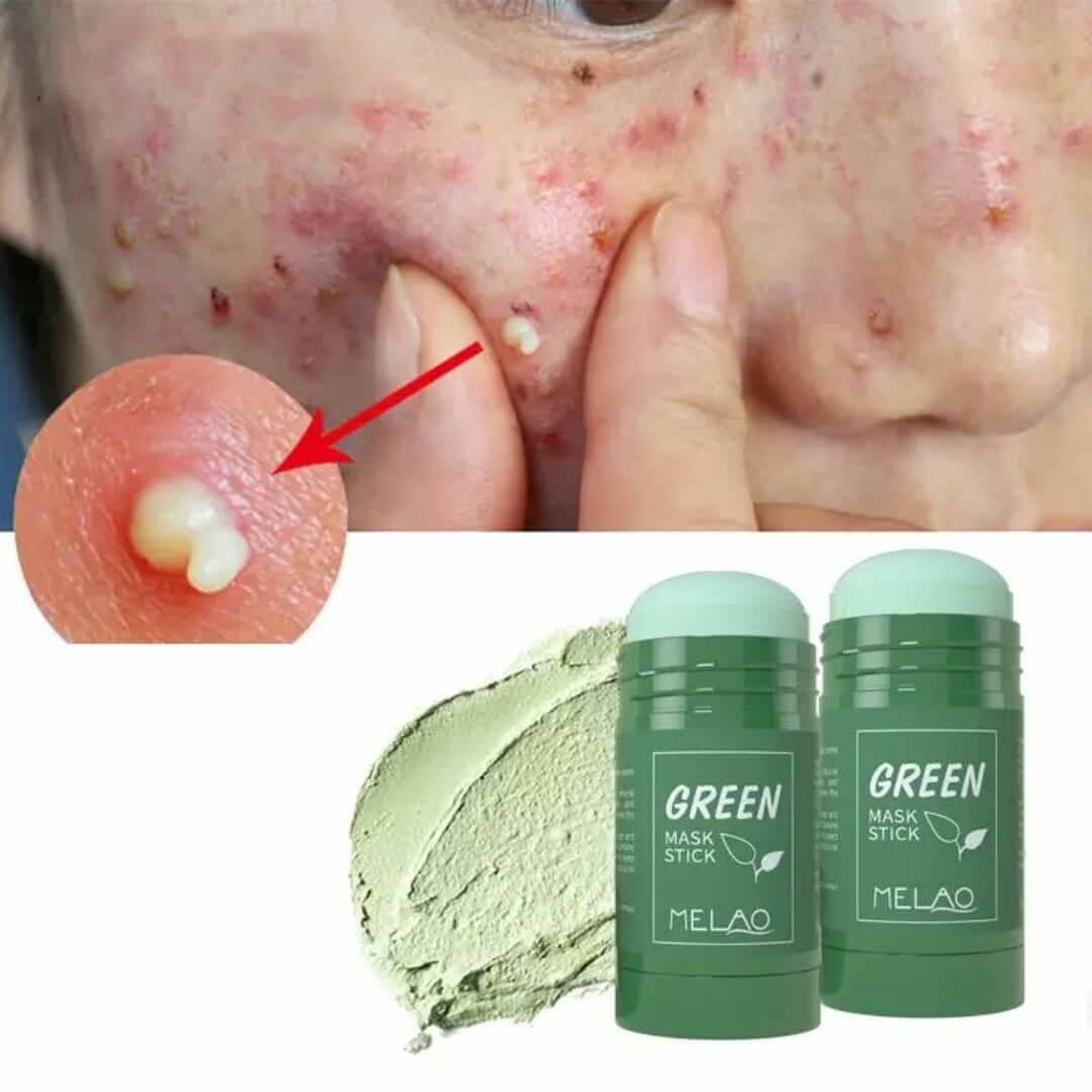 Stick Masque Vert Anti-Peaux