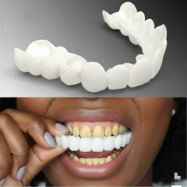 Facettes Dentaires Instantanées